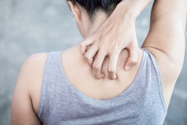 Mieux connaitre le psoriaris